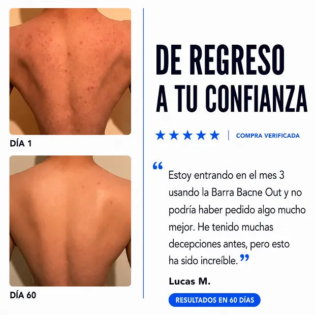 Reduce visiblemente el acné de espalda y cuerpo en semanas